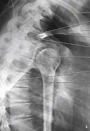 <p>What type of projection, position and anatomy is this?</p>