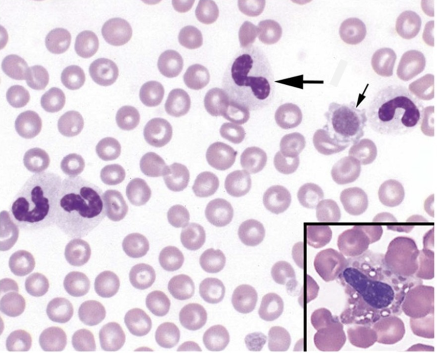 The leukocytes found on this image are 