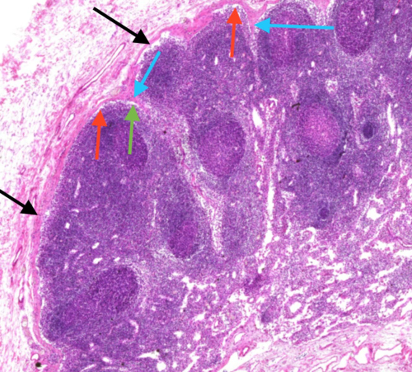 <p>Afferent lymphatics deliver fluid from the tissues to it. contains cells that have encountered pathogens</p>
