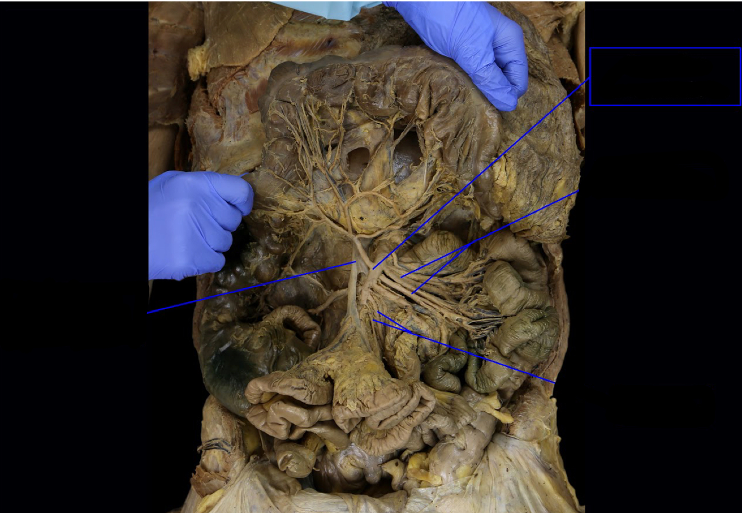<p>what abdominal region does this structure supply?</p>