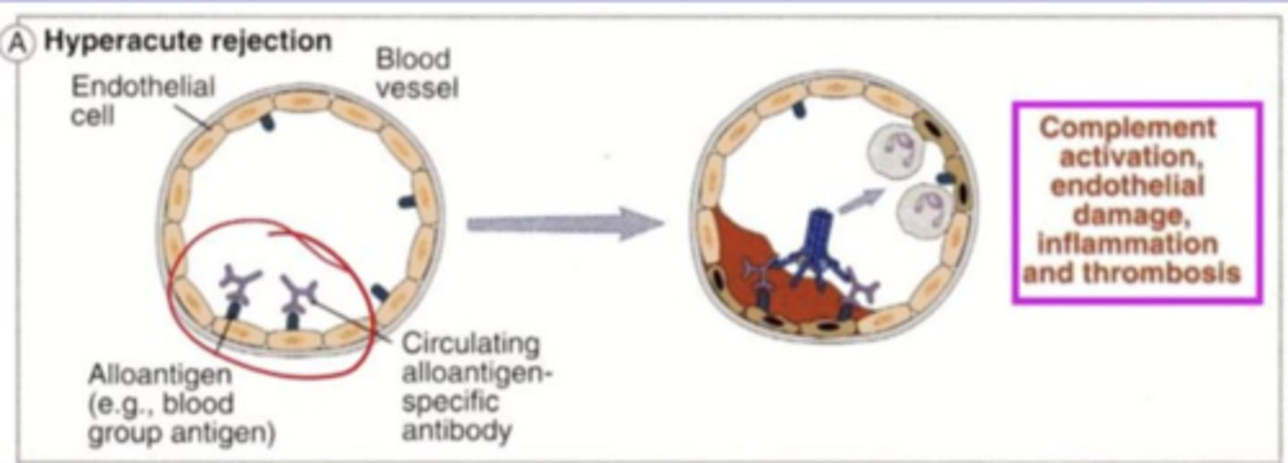 <p>they activate complement, resulting in thrombosis and ischemic necrosis</p>