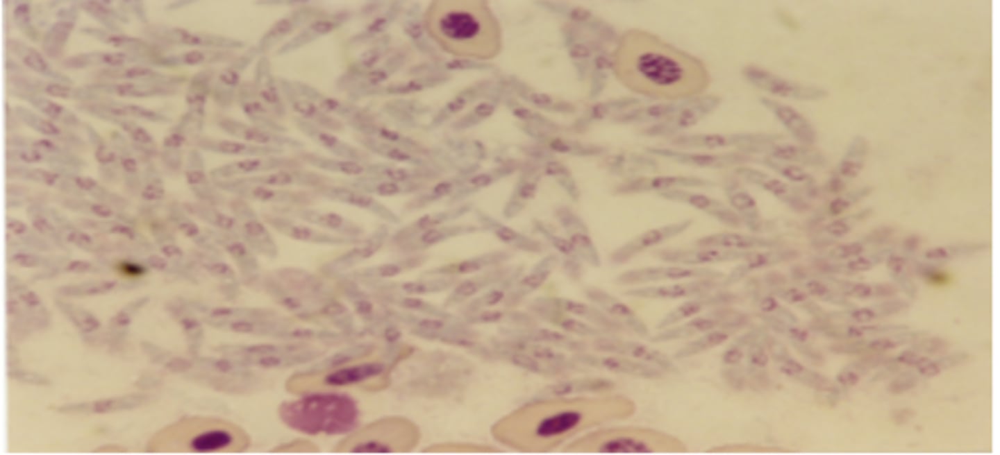 <p>Slide from a dead chicken - What parasite and life stage is this?</p>