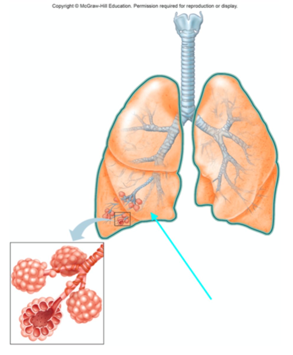 <p>Which lobe of the lungs is the blue arrow pointing at?</p>