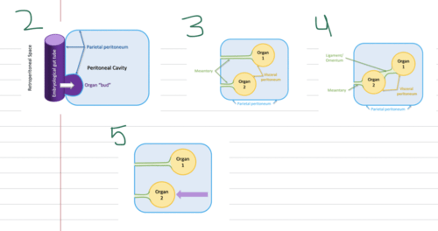 <p>1) All GI organs begin developing posterior to the peritoneal sac</p><p>2) Organs move anteriorly and press into the sac during development</p><p>3) Peritoneum pinches closed posterior to advancing organs</p><p>4) Organs rotate and mesenteries may fuse during development</p><p>5) Organs may move posteriorly after developing a mesentery</p>