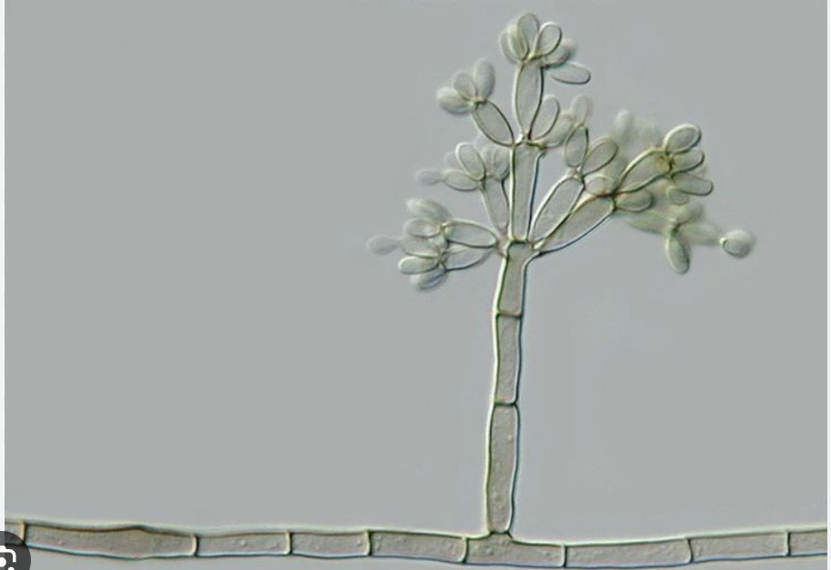 <p>Related to fungi; genus not specified in provided text.</p>
