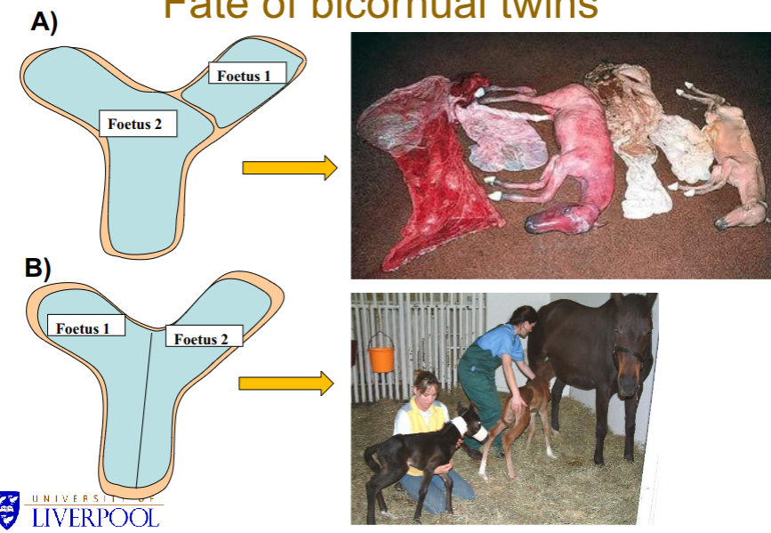 <p>A = one foetus gets more nutrients than the other so 1 dies and the toxic products produced causes the other to die</p>