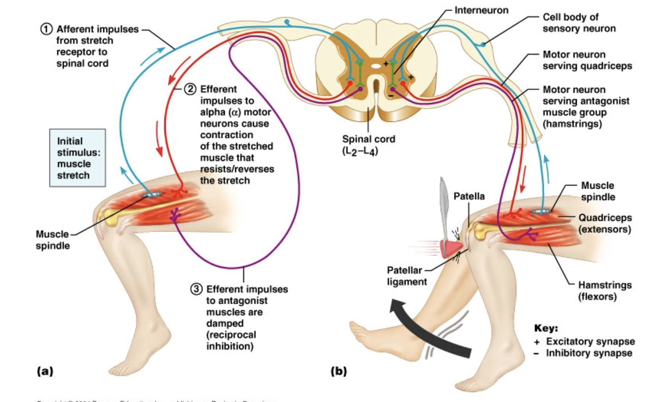 <ul><li><p><strong>Patellar (knee-jerk) reflex</strong> involves both <strong>excitation</strong> and <strong>inhibition</strong>.</p></li><li><p><strong>Excitation:</strong> Ia sensory neuron activates <strong>α-motor neuron → quadriceps contract</strong>.</p></li><li><p><strong>Inhibition:</strong> same Ia sensory neuron activates <strong>inhibitory interneuron → inhibits α-motor neuron to hamstrings</strong>, preventing antagonist contraction.</p></li><li><p>Ensures <strong>coordinated movement</strong> (one muscle contracts while the opposite relaxes).</p></li></ul><p></p>