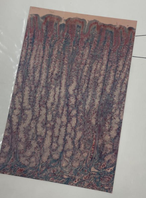 <p>what is this? what epithelial cells are the lines pointing to?</p>