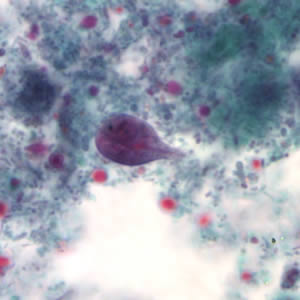 term image