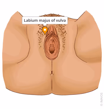 <p>Female (labi.maj)</p>