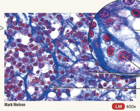 <p>Mature Connective Tissue; loose connective tissue: Reticular Connective Tissue</p>