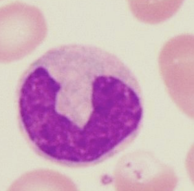 <p>can differentiate into macrophages and phagocytize debris; &gt;20um; largest; large monocyte</p>