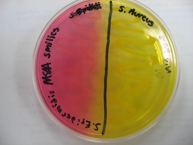 What is the name of this medium? What are the results for *S. epidermidis* (left) and *S. aureus* (right) (positive or negative)? What does this indicate about these organisms?