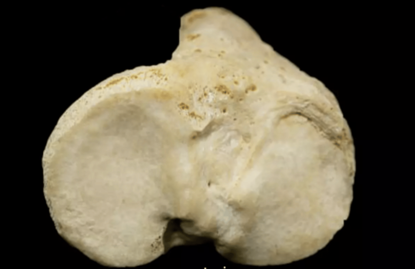 <p>What is the entire top portion?</p>