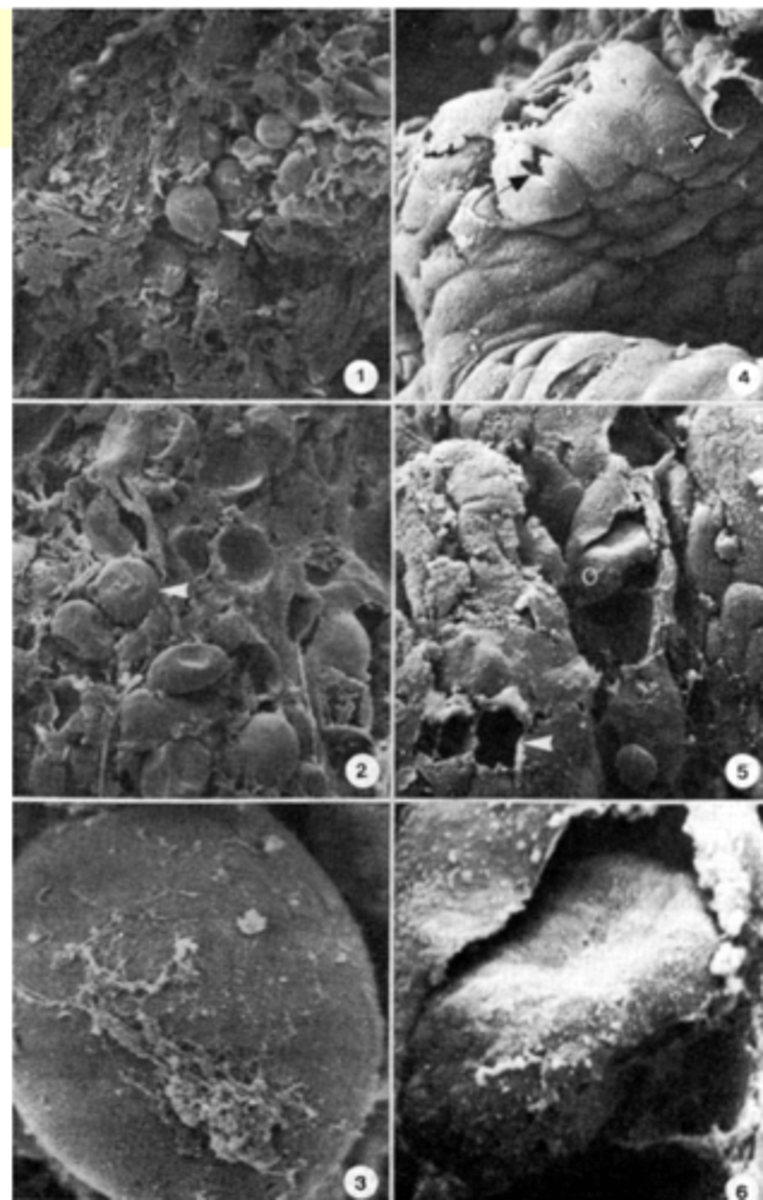 <p>Bacteria that normally reside in the digestive tract are required for production of the lesions specific to Coccidiosis;</p>