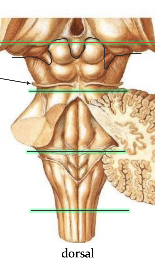 <p>Midbrain: CN IV (trochlear) </p>