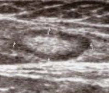 <p>What does this ultrasound image most likely represent?</p>