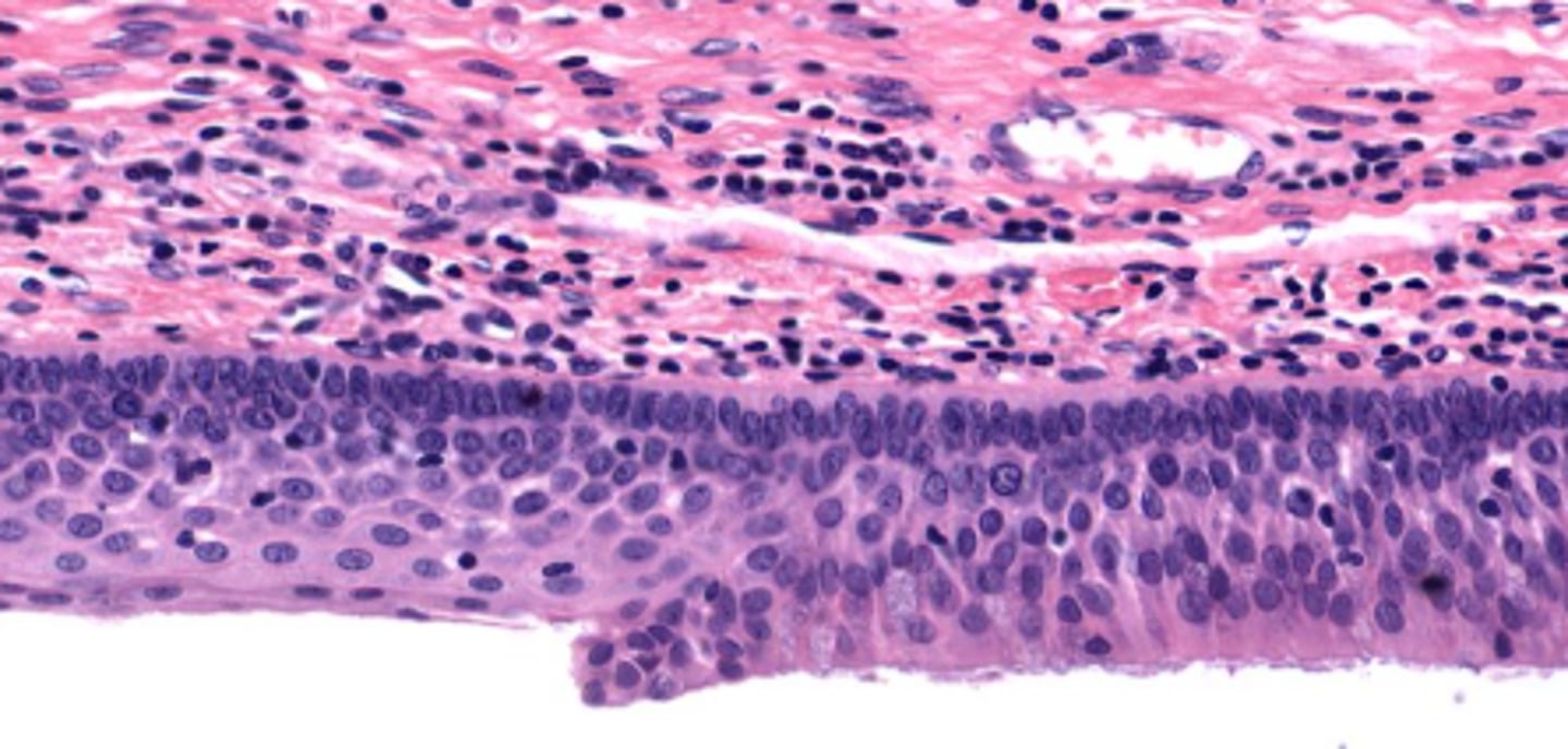 <p>posterior surface of epiglottis</p>