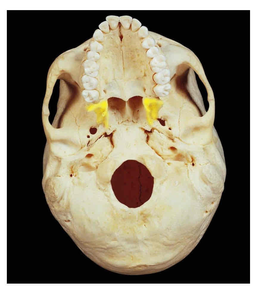 term image