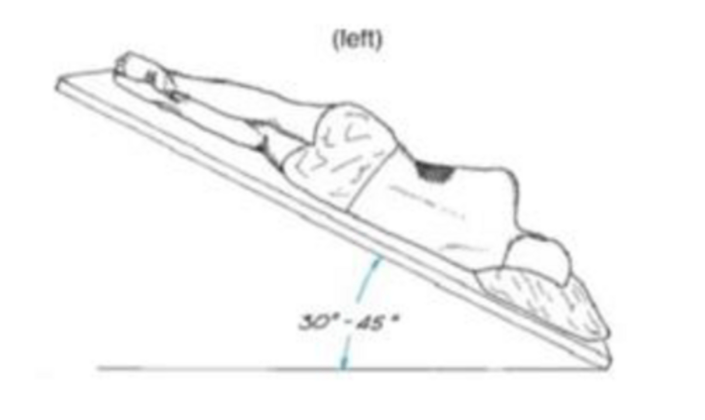 <p>patient lies on right side, in a 45 degree head-down position; percussion is applied over the lower lateral aspect of the left rib cage</p>