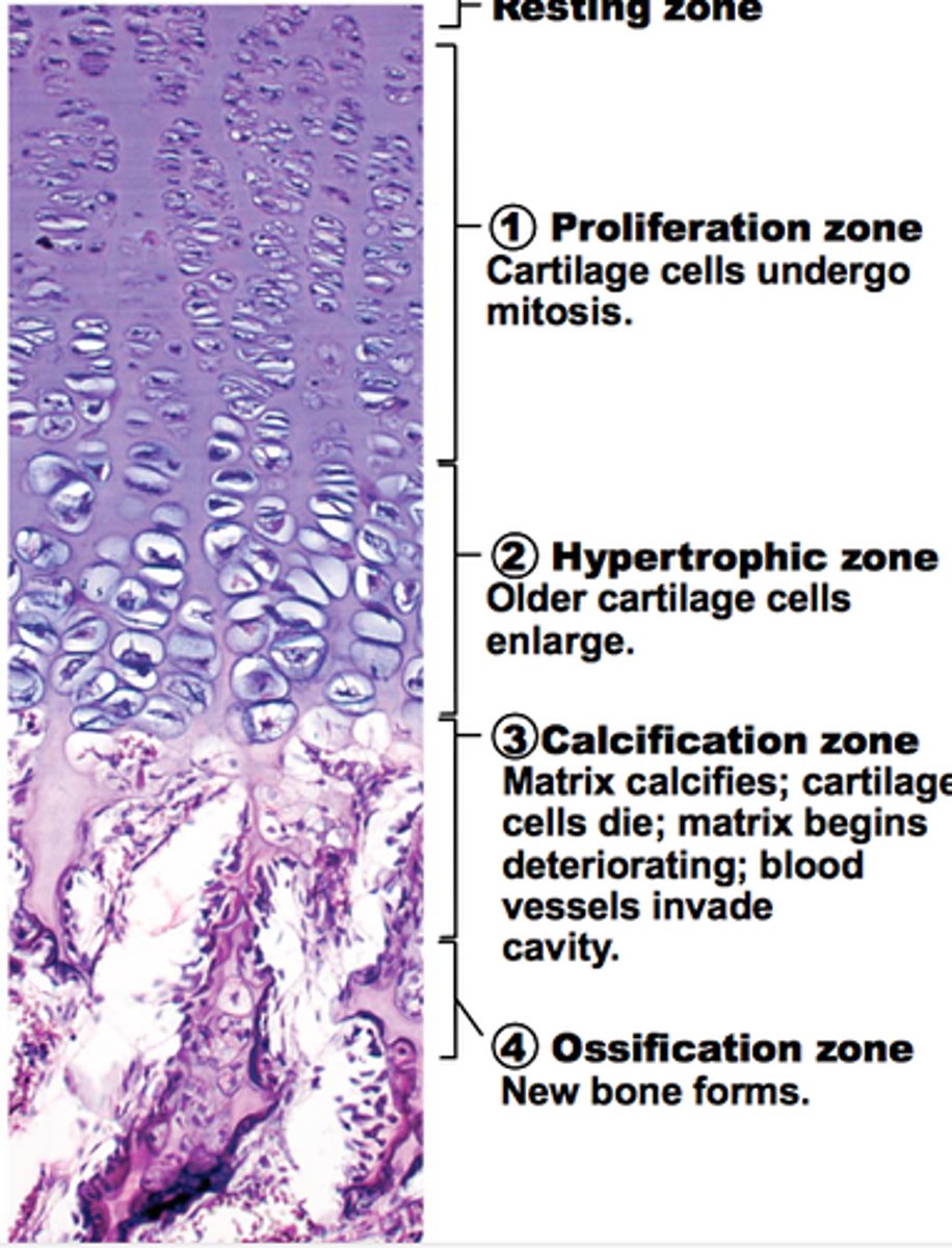 <p>ossification at diaphyseal side of plate</p>