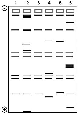 <p>This figure shows the results of a gel electrophoresis separation of restriction fragments of the DNA of different organisms.</p><p>In the figure, which two organisms are most closely related?</p><ol><li><p>1 and 3</p></li><li><p>2 and 4</p></li><li><p>2 and 5</p></li><li><p>3 and 5</p></li><li><p>4 and 5</p><p></p></li></ol><p></p>