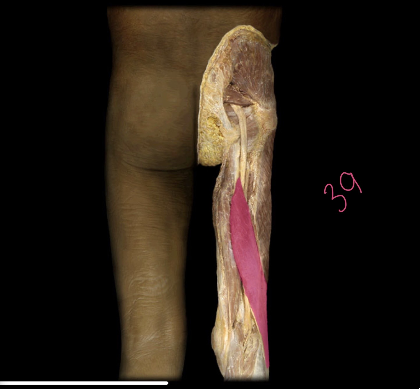 <p>Long head of biceps femoris</p>