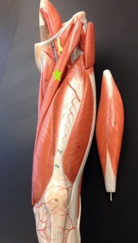 <p>Identify the Muscle. </p>