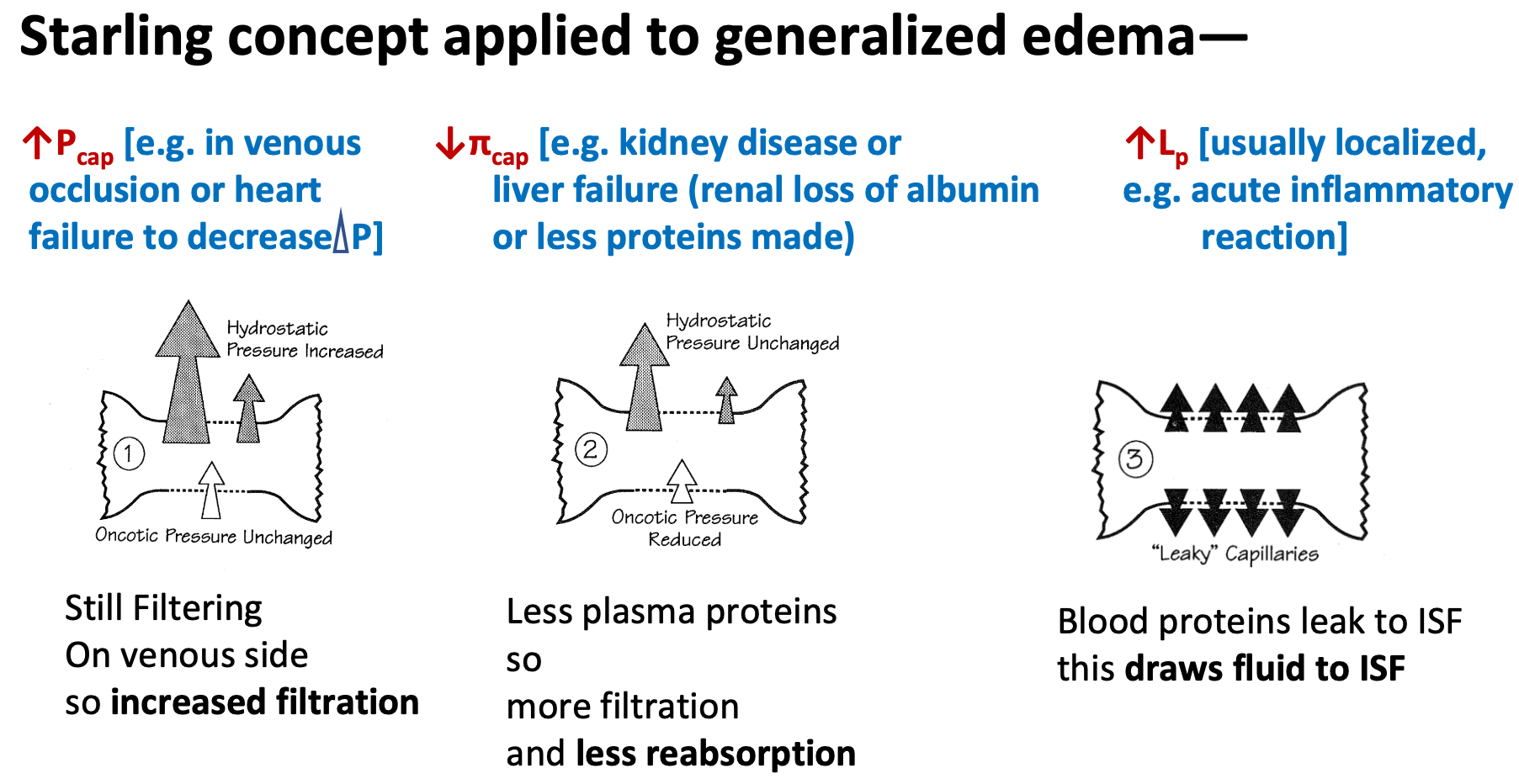 <ol><li><p>Swelling in most dependent parts of body—due to combination of net imbalance between “Starling forces” and gravity [Pressures expressed as mm Hg]</p></li><li><p>Increase pressure in capillaries</p><ol><li><p>Increase filtration</p></li></ol></li><li><p>Decrease proteins made</p><ol><li><p>Less reabsorption</p></li></ol></li><li><p>Draws build to ISF</p></li><li><p>Generalized edema = expanded interstitial volume</p></li></ol>