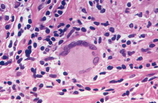 term image