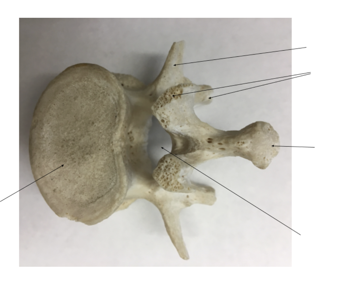 <p>Left:</p><ol><li><p></p></li></ol><p>Right:</p><ol><li><p></p></li><li><p></p></li><li><p></p></li><li><p></p></li></ol><p></p>