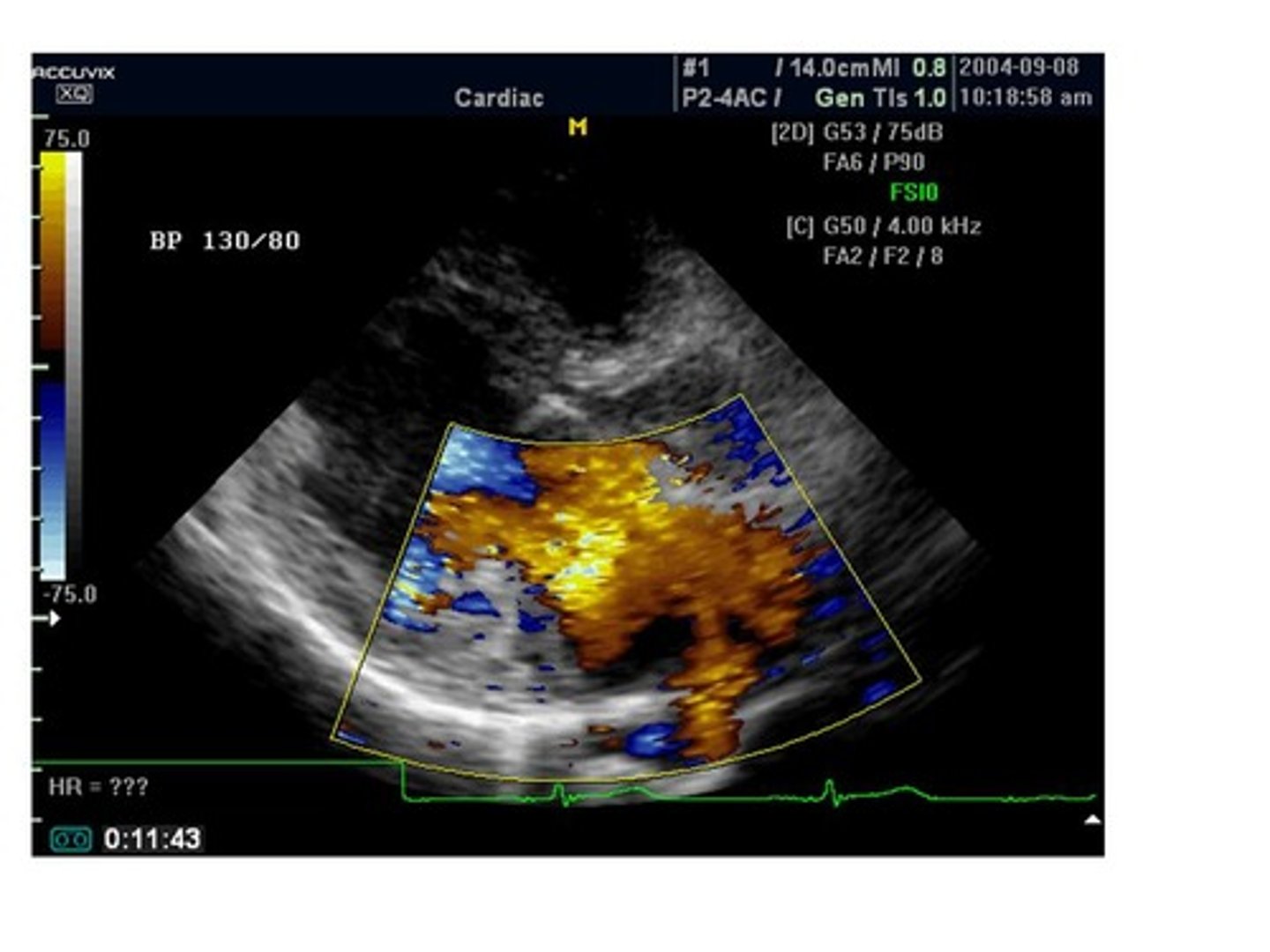 <p>flow toward the transducer</p>