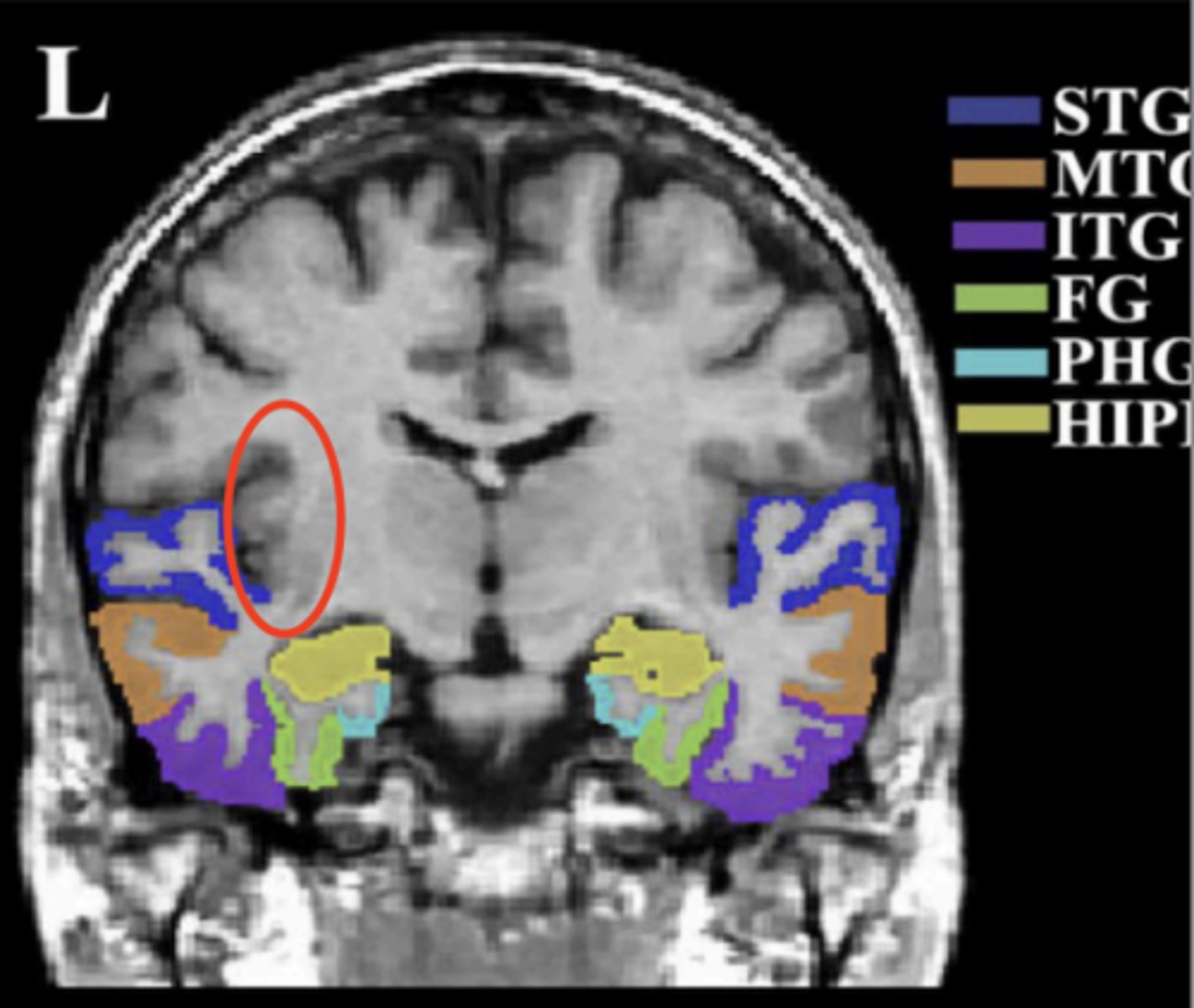 <p>circled in red, next to STG</p>
