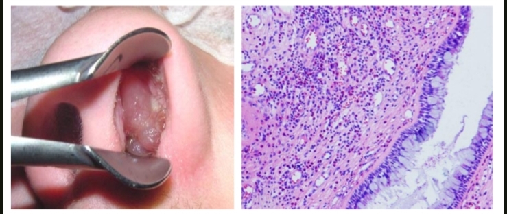 <p>identify ?</p><p>composed of ?</p>