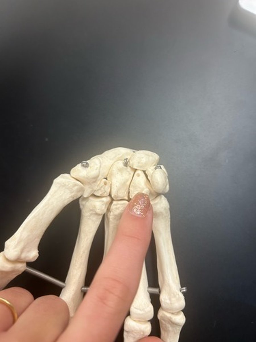 <p>name the bone</p>