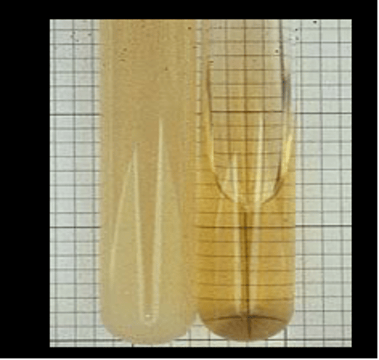 <p>what c/s is shown to indicate UTIs</p>