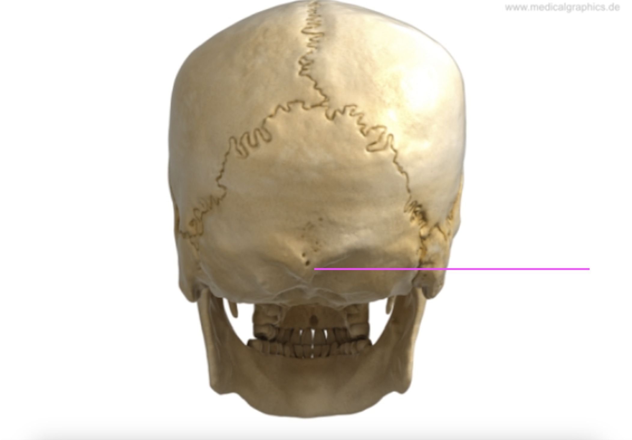 <p>What bone marking is this?</p>