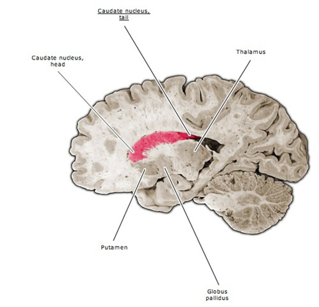 <p>a vertical slice of the brain cut down the center form the anterior to the posterior giving a view from left or right</p>