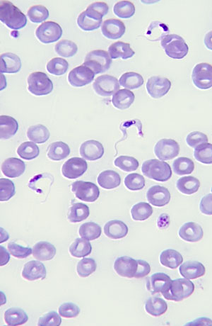 Trypanosoma cruzi