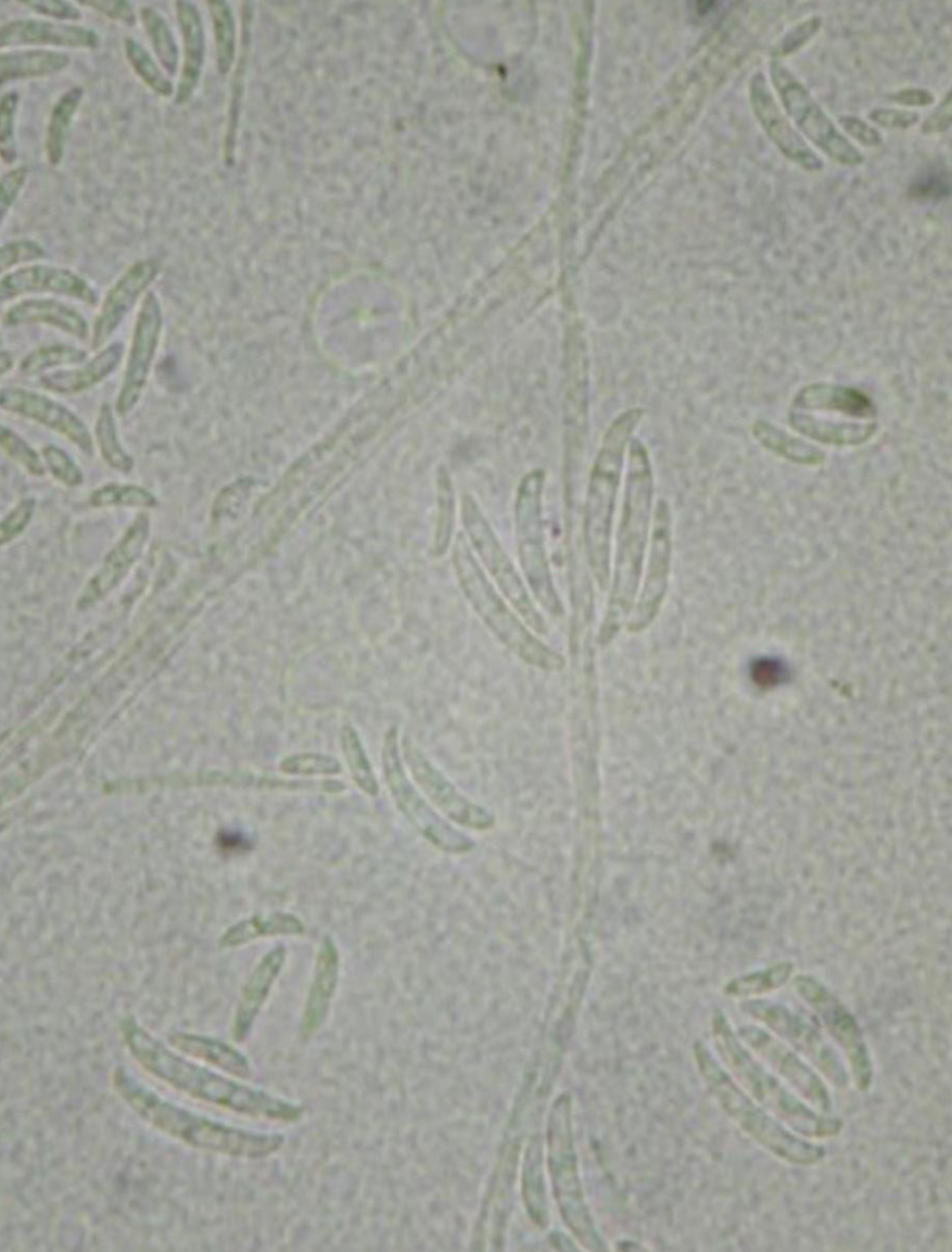 <p>Fusarium sp. - zarodniki konidialne</p>