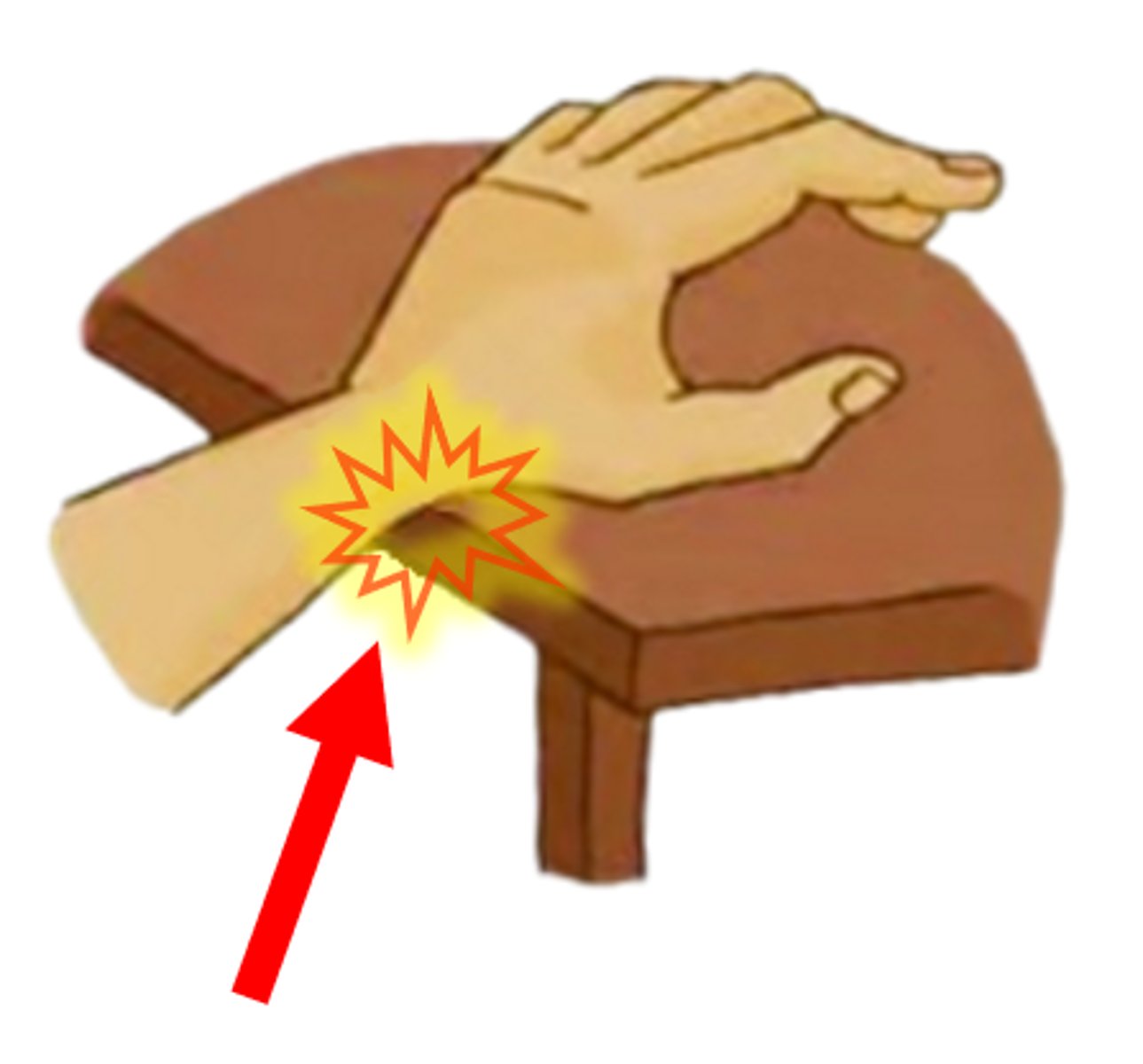 <p>continuous pressure between the body & a sharp edge (ergonomic stressor)</p>