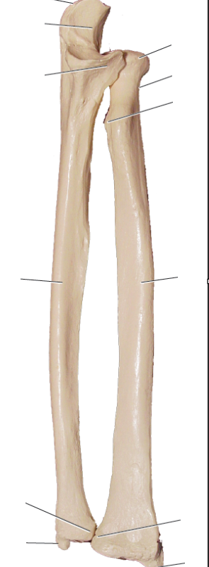 <p>Right or left pair </p>