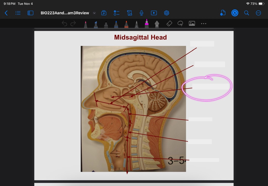 <p>What is this?</p>