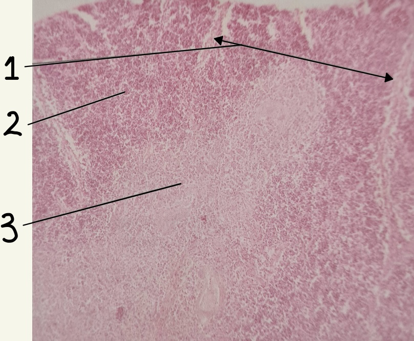 Thymus slide