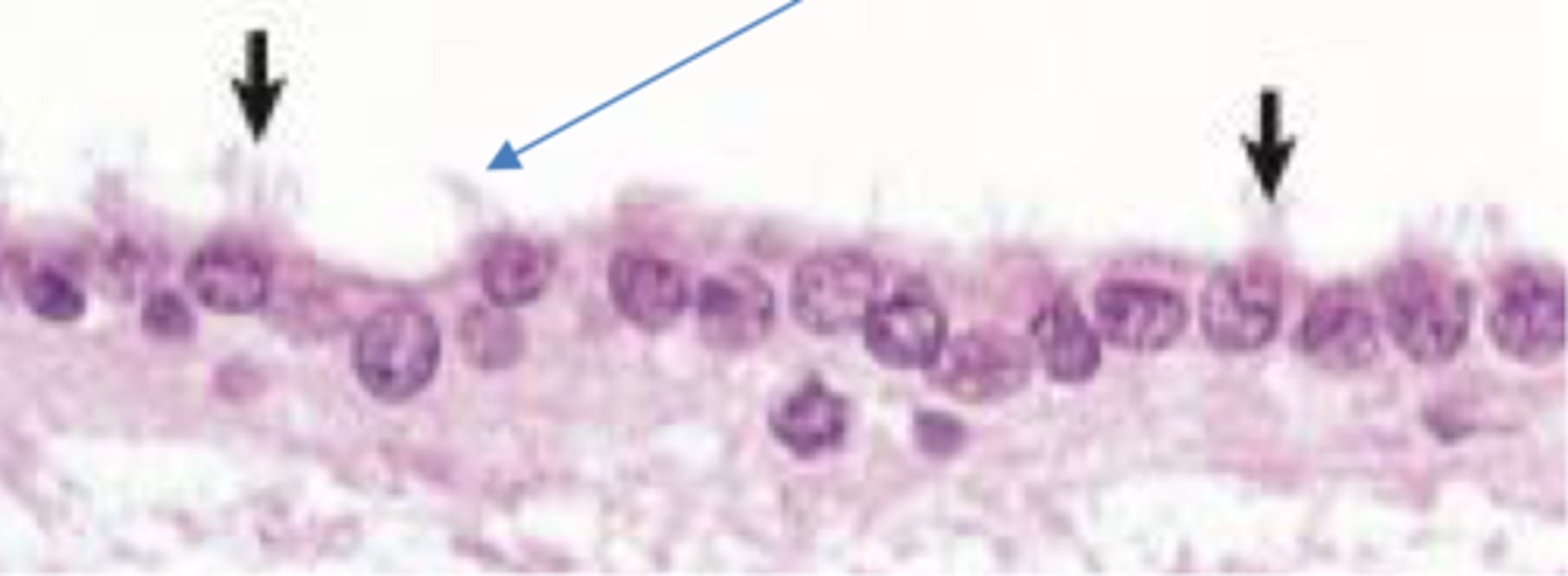 <p>- ciliated cuboidal epithelium</p><p>- line ventricles and central canal of spinal cord</p><p>- important part of brain/CSF barrier</p>