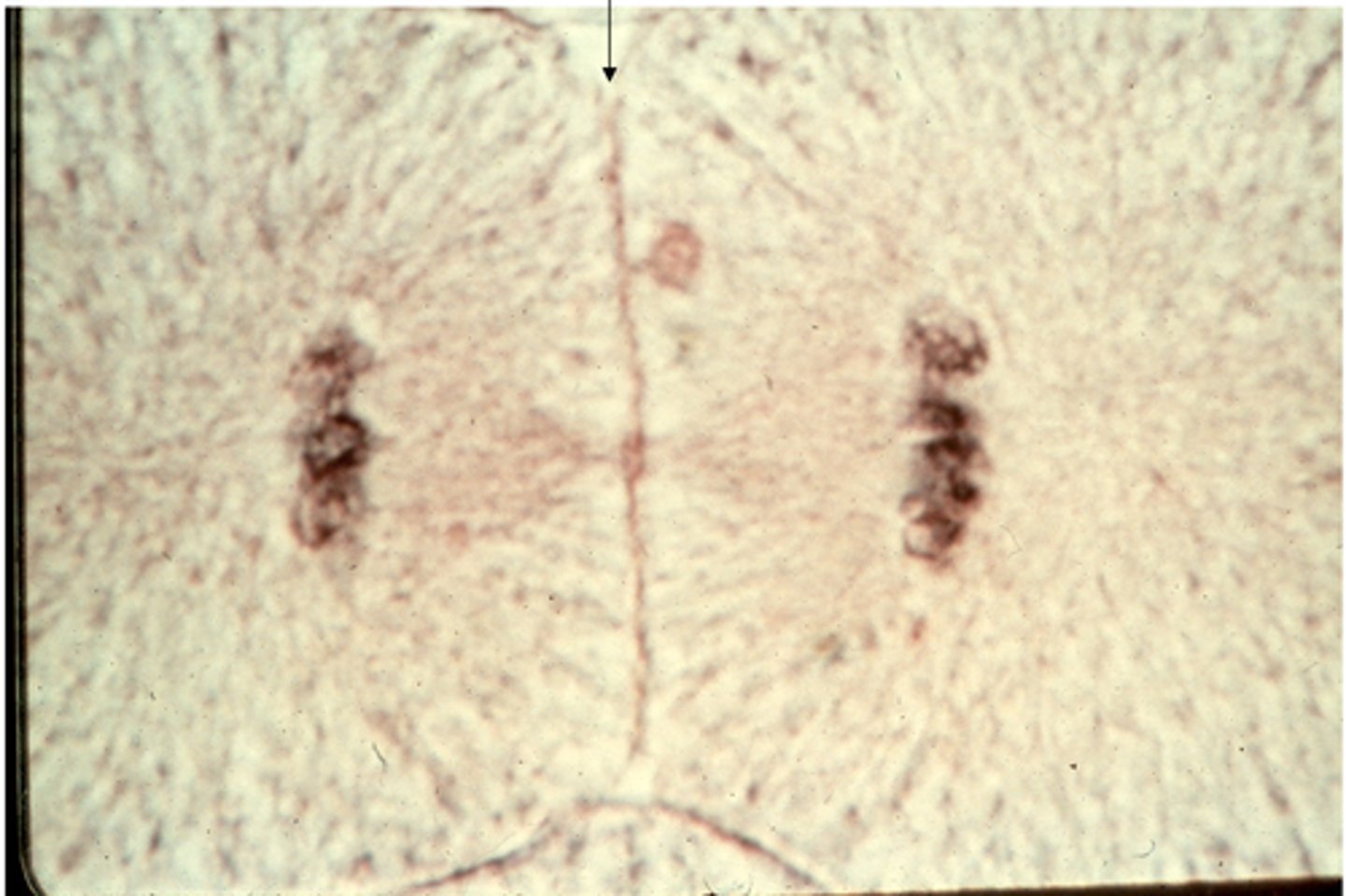 <p>This shows ________ in whitefish blastula. The arrow indicates the _______ ________.</p>