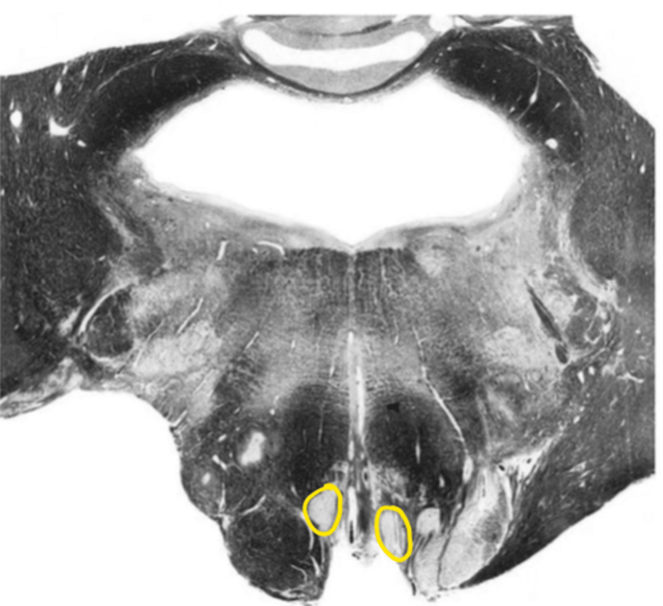 <p>ID the nucleus</p>