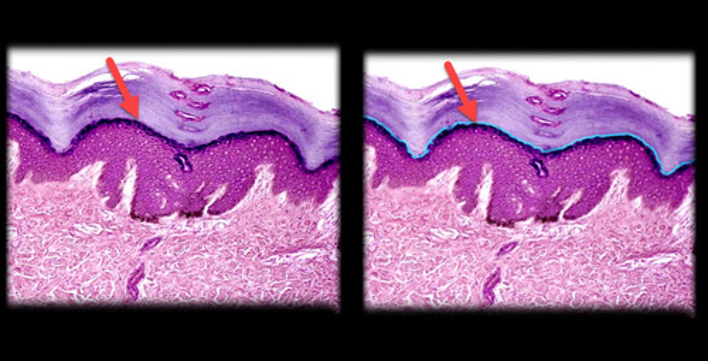 <p>- Thin, clear layer found only in thick skin (e.g., palms of the hands, soles of the feet).</p><p>- Appears as a thin, translucent layer just beneath the stratum corneum.</p><p>- Cells are dead, flattened, and lack visible organelles or nuclei, giving the layer a clear or glassy appearance.</p>