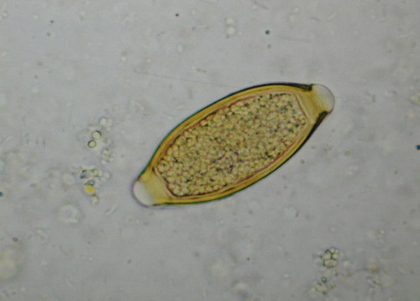 <p>APHASMID nematode; LEMON or BARREL shaped egg; also known as WHIP WORM</p><p>MOT: ingestion of EMBRYONATED egg</p>