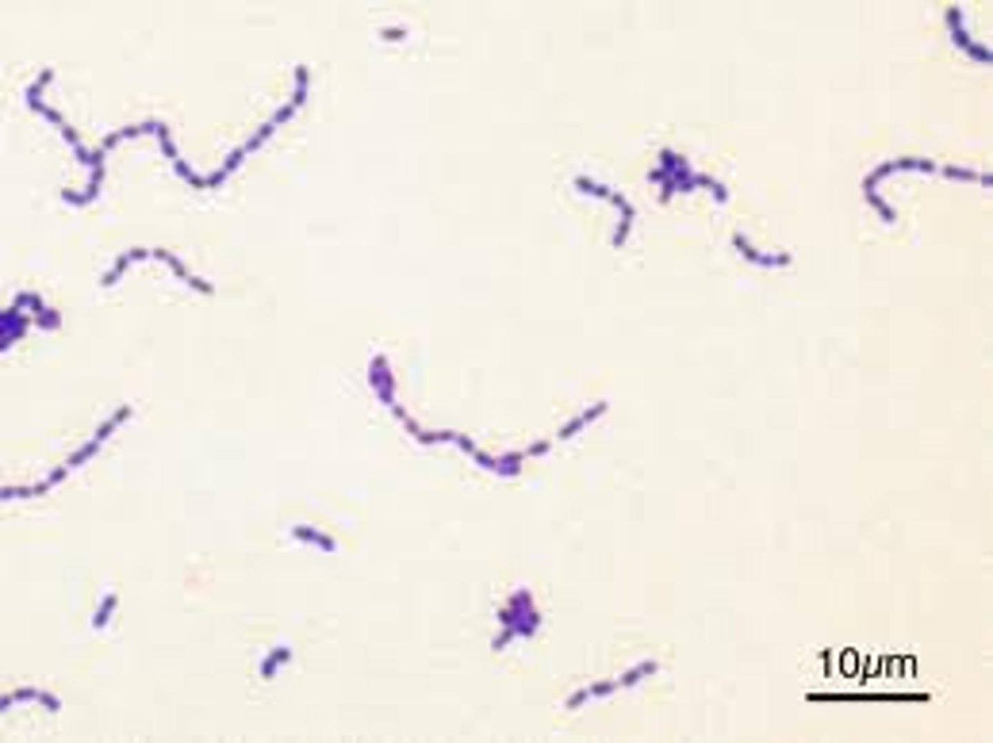 <p>The following image is an example of _____<br>a. diplococcus<br>b. staphylococcus<br>c. streptococcus<br>d. streptobacillus</p>